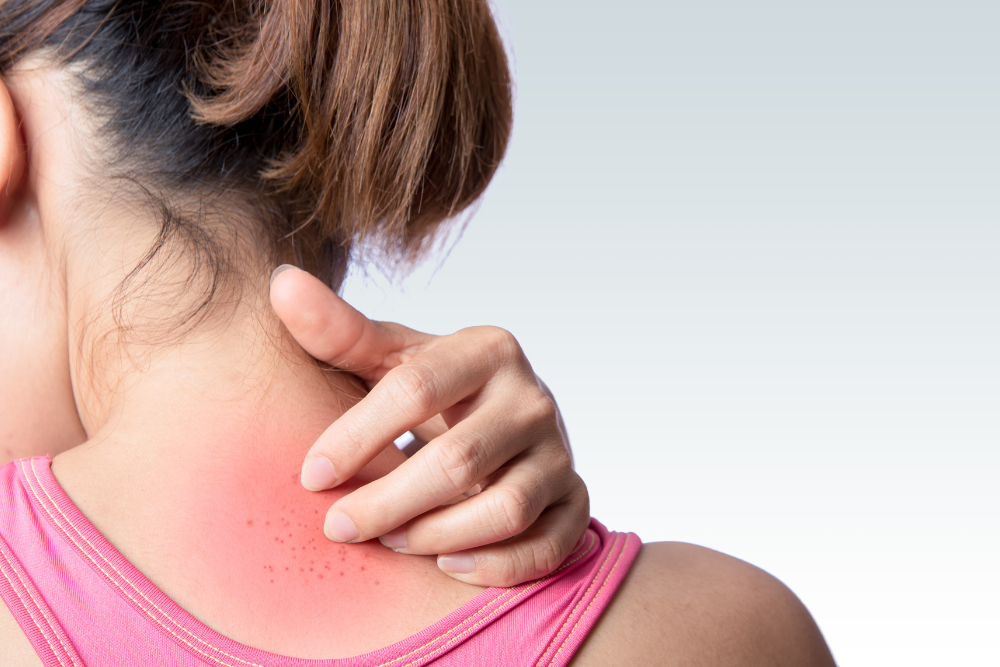 When Is It Time to Seek a Same Day Emergency Rash Appointment Near Springfield, Virginia?