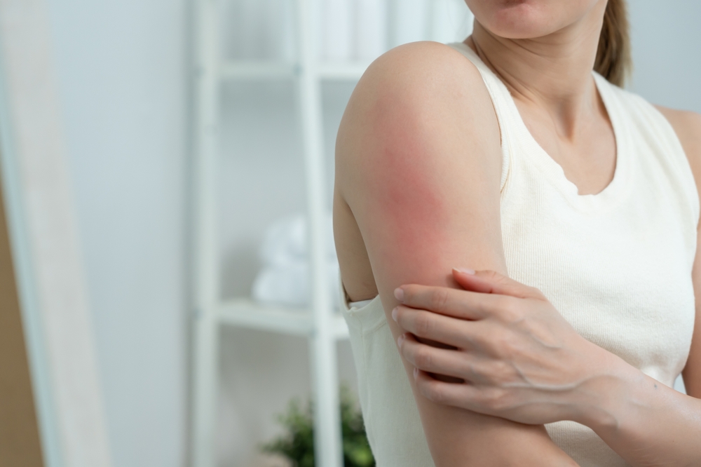 Urgent Care for a Skin Infection or Abscess Near West Falls Church, VA: When a Skin Infection Needs Timely Care