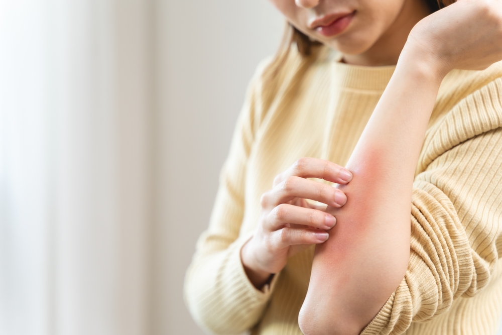 Patient Guide to Primary Care Visits for Allergic Reactions in Merrifield, Virginia