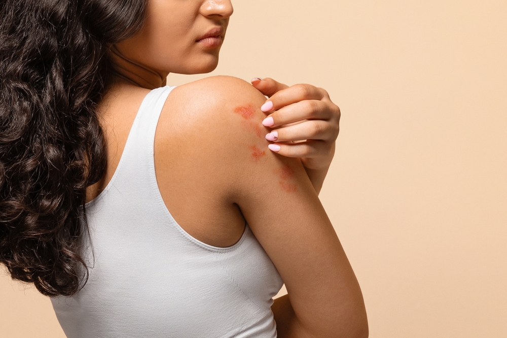 Same-Day Primary Care Appointments for Rashes in North Springfield, Virginia: What to Expect