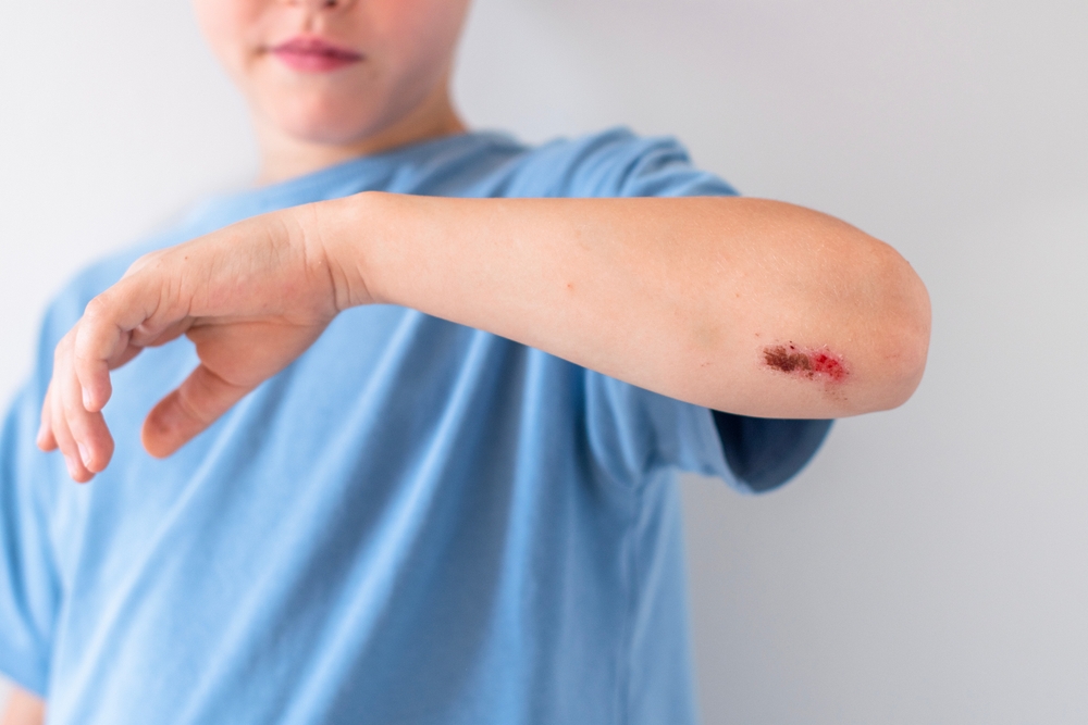 Guide to Urgent Care in Fairfax County, Virginia for Minor Cuts, Burns, and Wounds