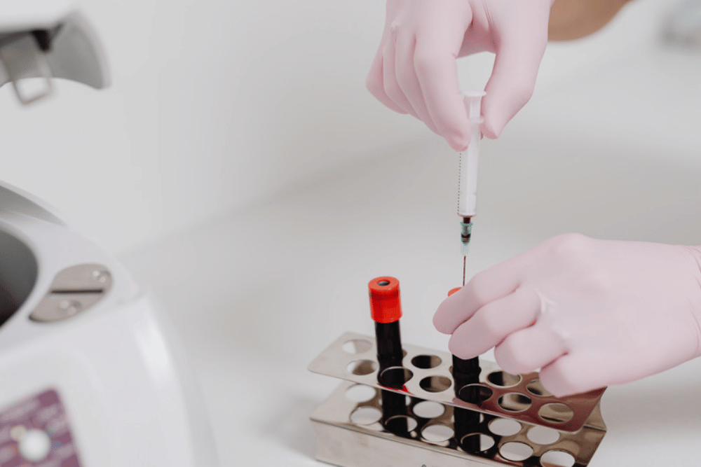 Cholesterol Testing in Fairfax, VA: When Should You Have Your Cholesterol Checked During a Primary Care Appointment?